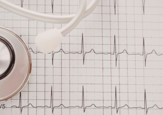 GPs regain Medicare rebate for ECG tracing from March 2026