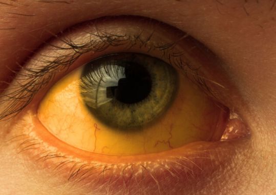 Australia clears trachoma as public health concern