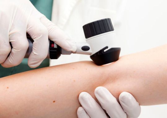Queensland Skin Cancer Costs Highlight Need for Stronger Prevention