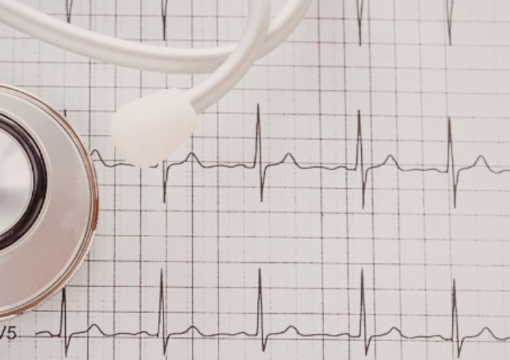 GPs regain Medicare rebate for ECG tracing from March 2026