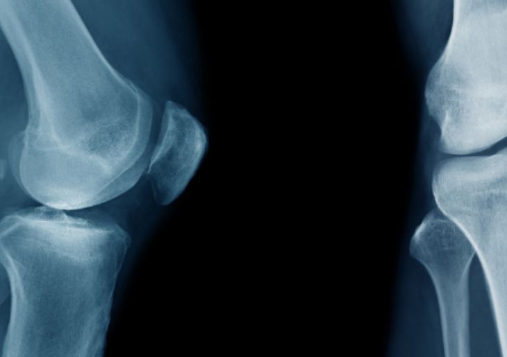 Changes to Diagnostic Imaging Reports in My Health Record