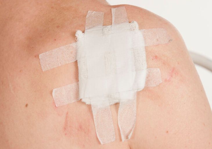 New Data Guides Targeted Skin Cancer Screening in Australia