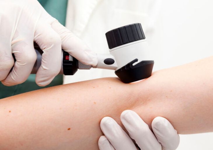 Queensland Skin Cancer Costs Highlight Need for Stronger Prevention